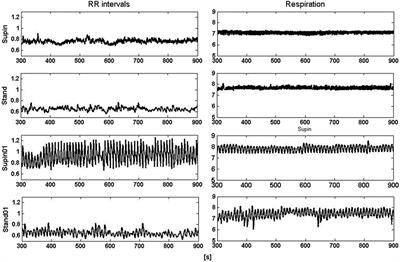 Slow 0.1 Hz Breathing and Body Posture Induced Perturbations of RRI and Respiratory Signal Complexity and Cardiorespiratory Coupling